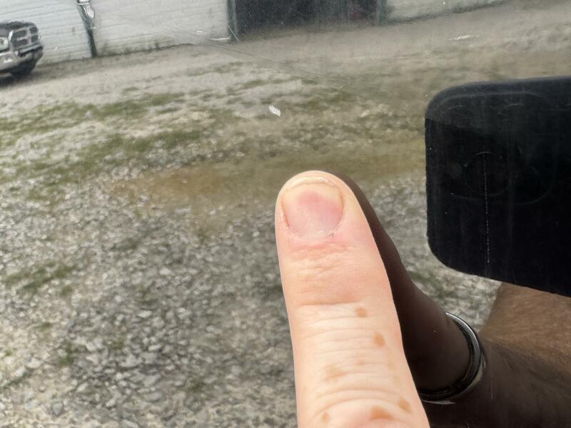 20' 2008 Mastercraft X-2